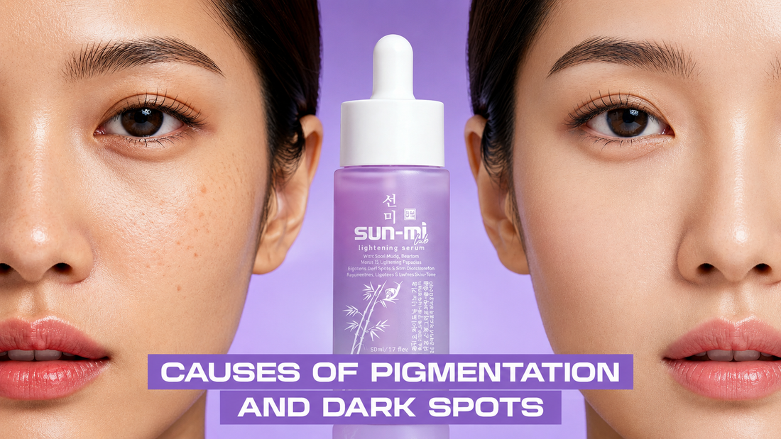 Causes of Hyperpigmentation and Dark Spots