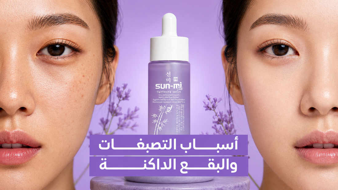 اسباب التصبغات والبقع الداكنة